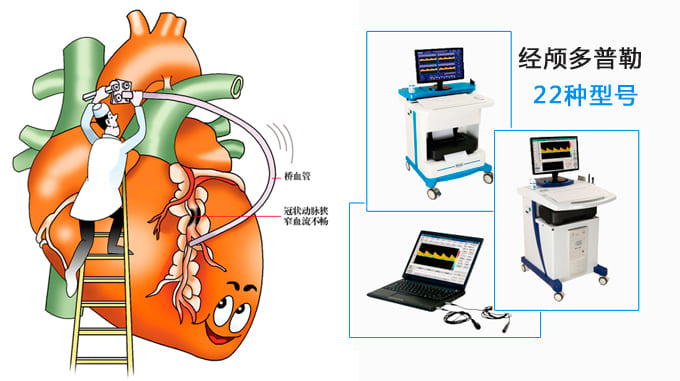 心肌梗死呵護(hù)_經(jīng)顱多普勒_tcd檢查.jpg