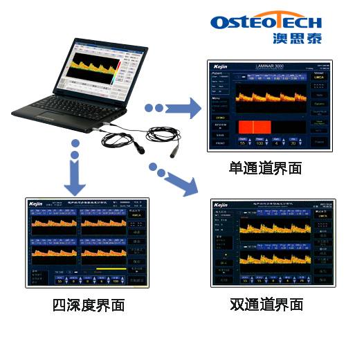 筆記本多普勒檢測(cè)圖_CT_tcd.jpg